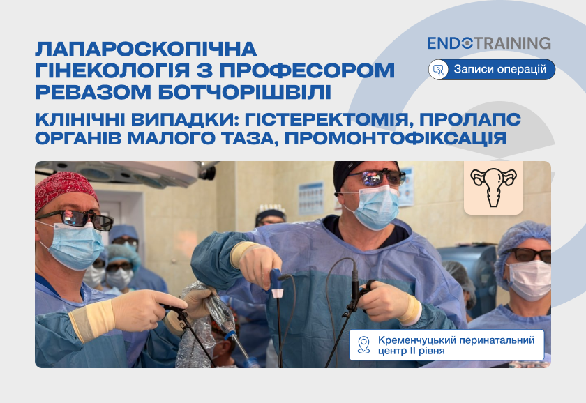 Лапароскопічна гінекологія з професором Ревазом Ботчорішвілі (Записи операцій)