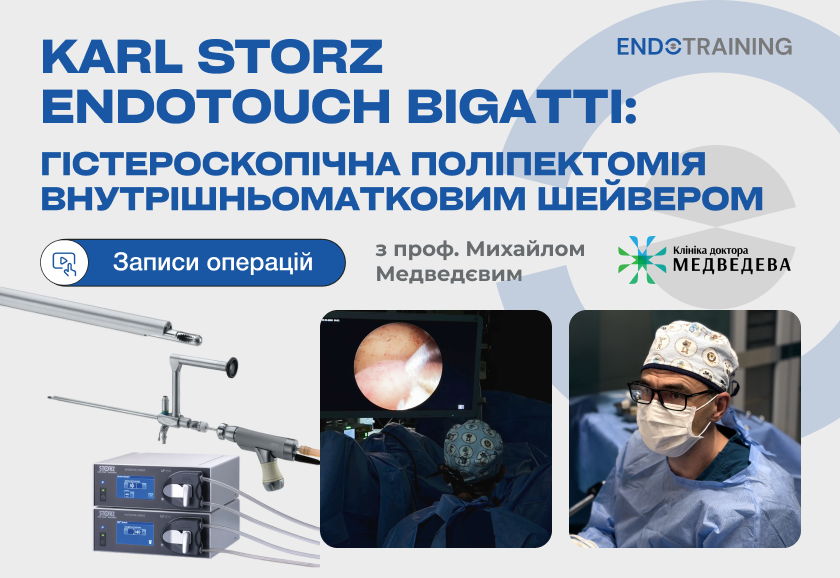 KARL STORZ ENDOTOUCH BIGATTI: гістероскопічна поліпектомія внутрішньоматковим шейвером. Записи операцій з проф. Михайлом Медведєвим